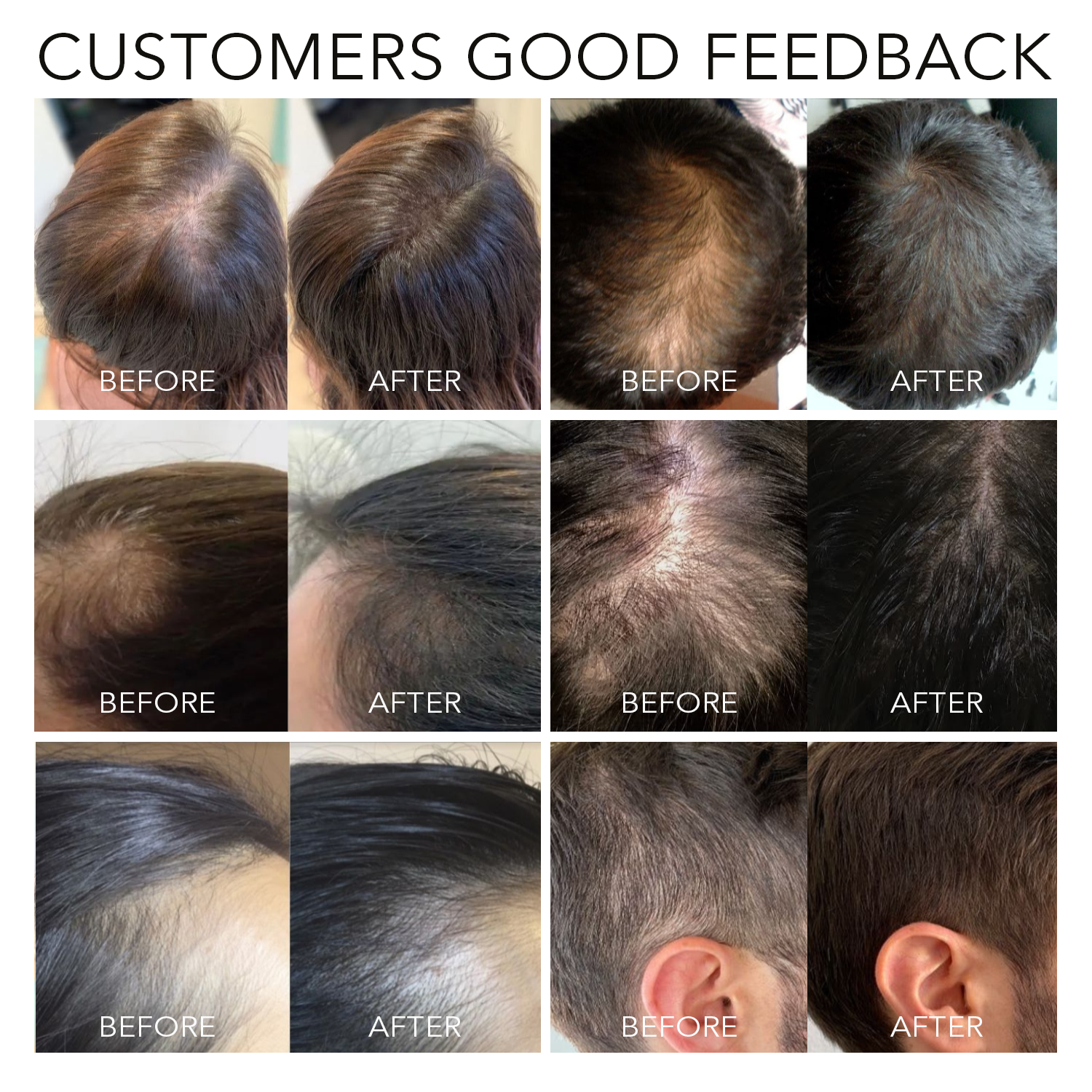 Private label OEM ODM Rosemary Hair Growth Oil Serum